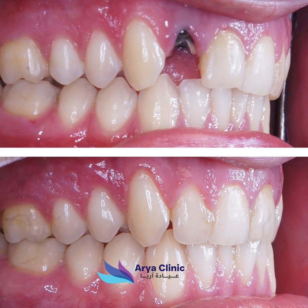 Dental Before and After 1