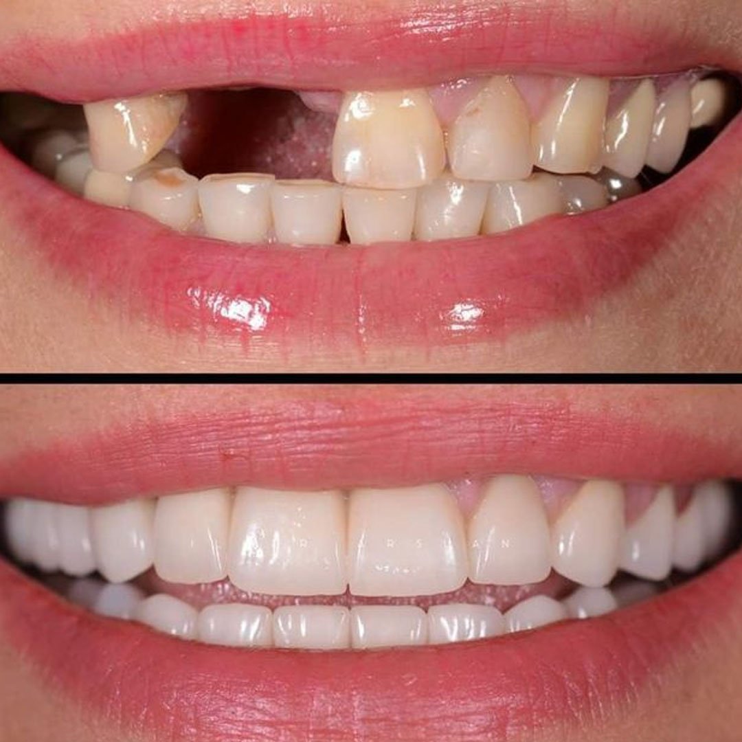Dental Before and After 1