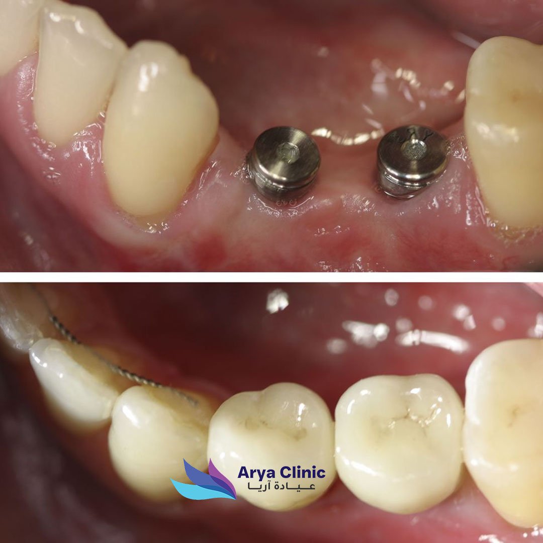 Dental Before and After 2