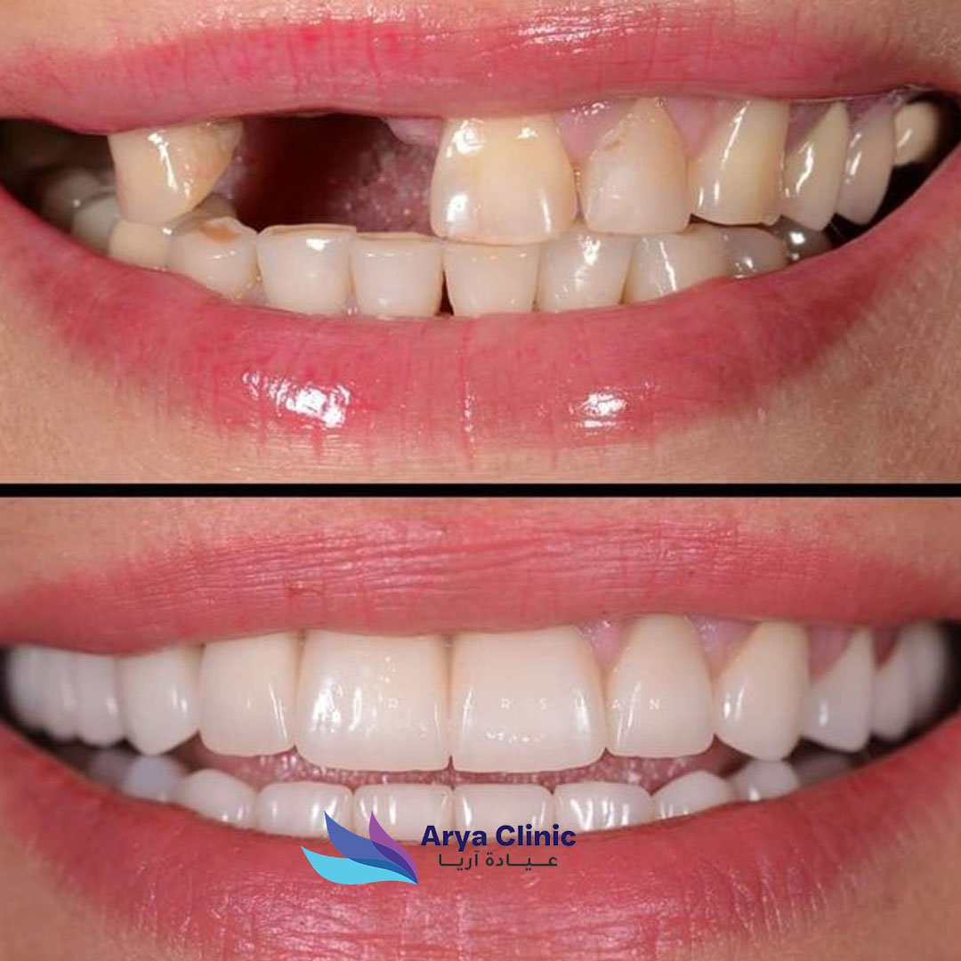 Dental Before and After 3