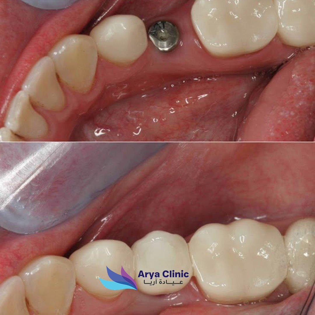 Dental Before and After 4