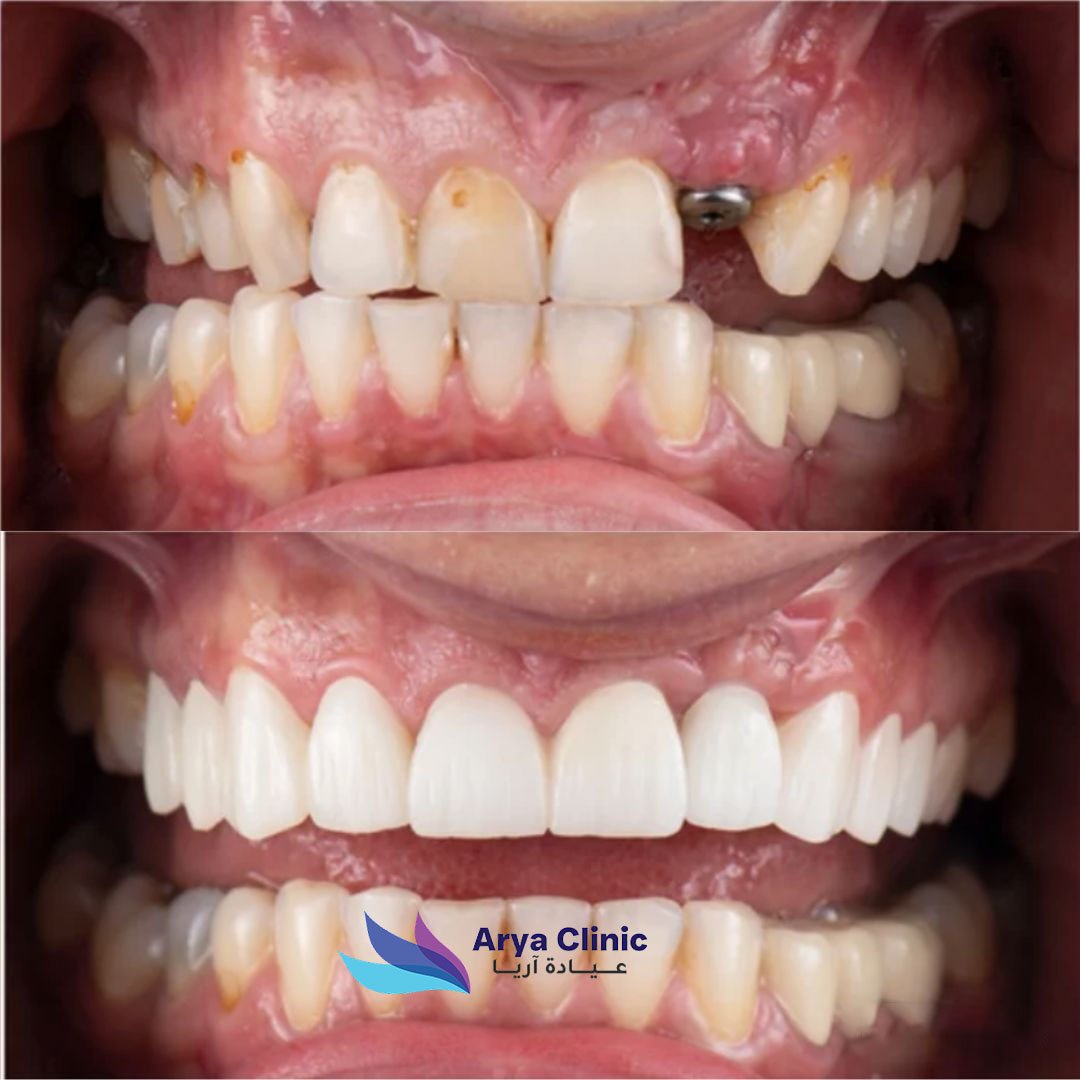 Dental Before and After 5