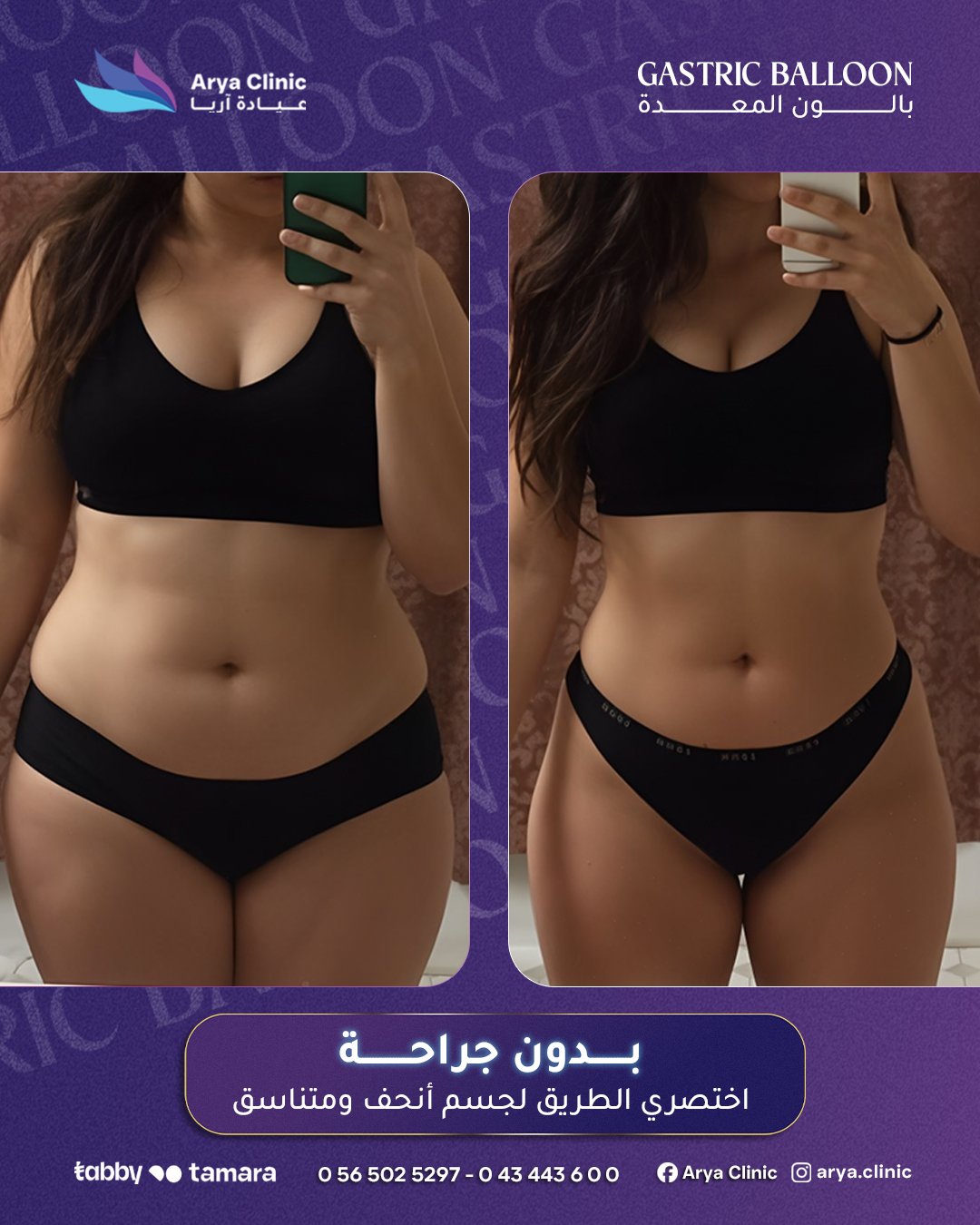 تحكم بشهيتك واخسر الوزن الزائد مع الكبسولة الذكيةطريقة آمنة وسهلة للتخلص من الدهونتمنحك قواماً م