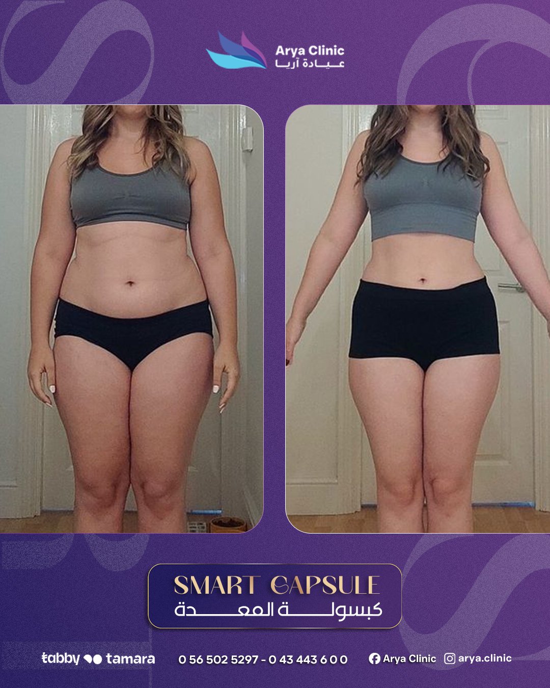 كبسولات المعدة خيار فعّال لدعم خسارة الوزن بطريقة آمنة ومريحة.تساعد على تقليل الشهية وتحسين عملي