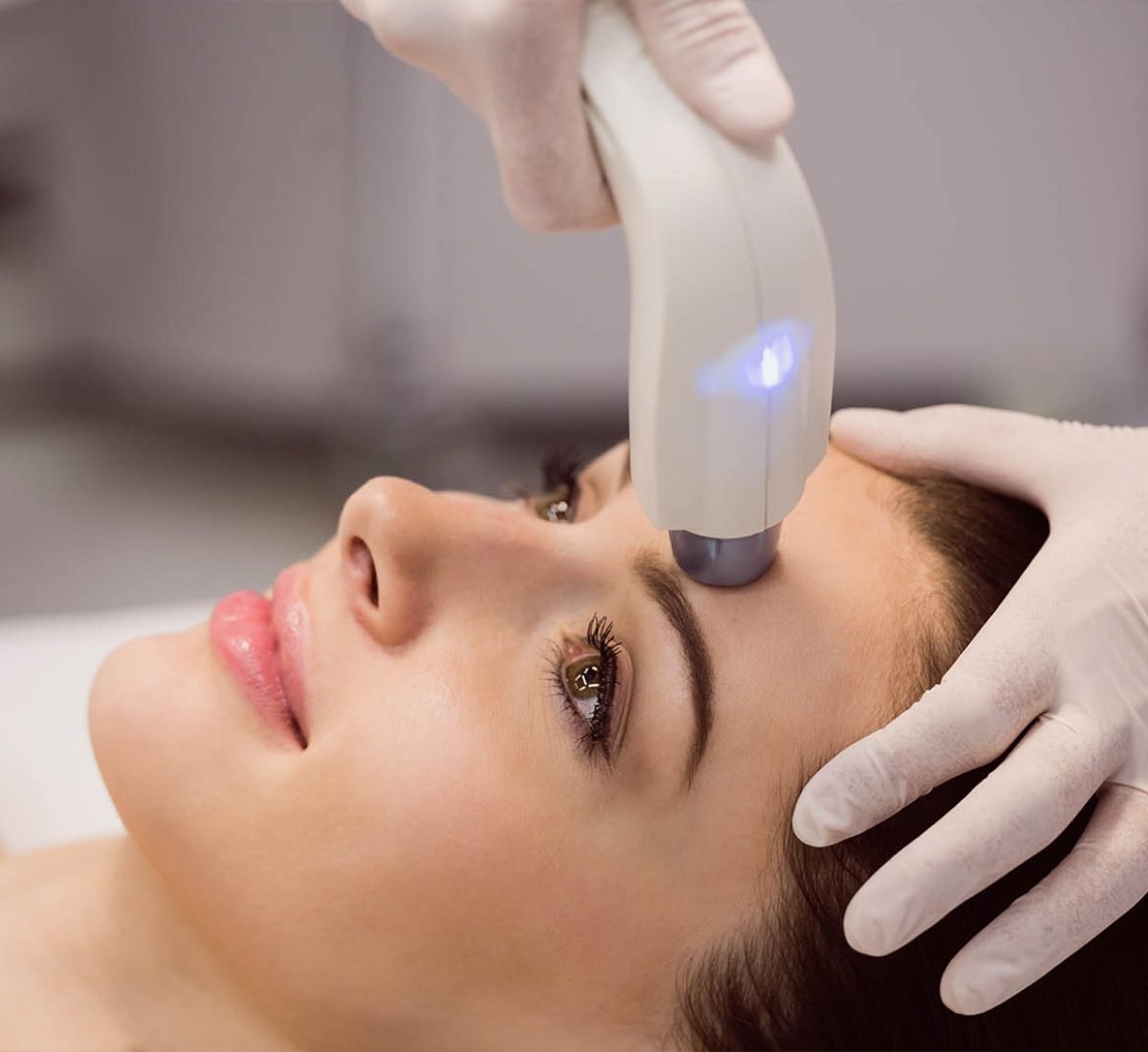 Fractional Laser Rejuvenation