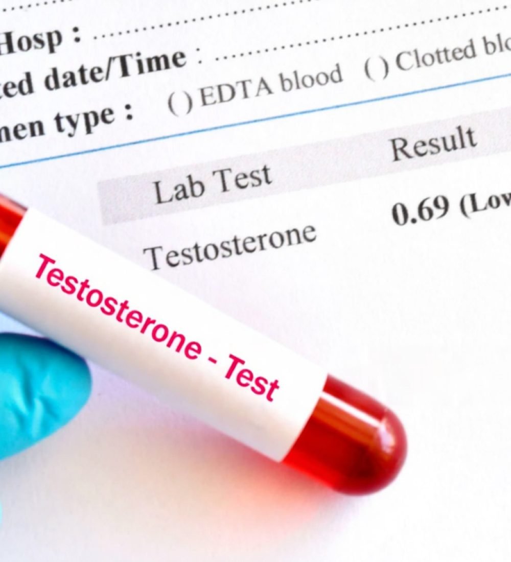Low Testosterone